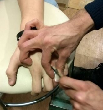 Спасатели помогли подростку снять кольцо с пальца