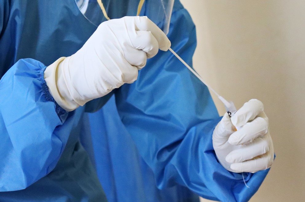 В Ульяновской области за сутки коронавирусом заболели 473 человека