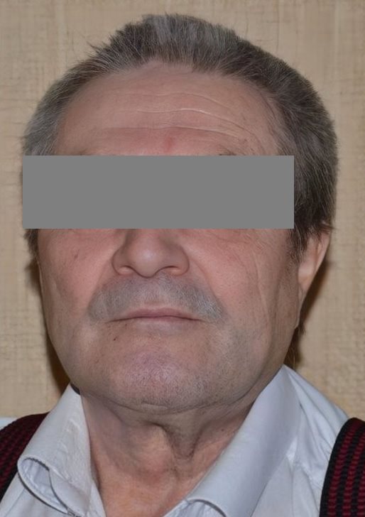 Пропавшего в Димитровграде пенсионера нашли