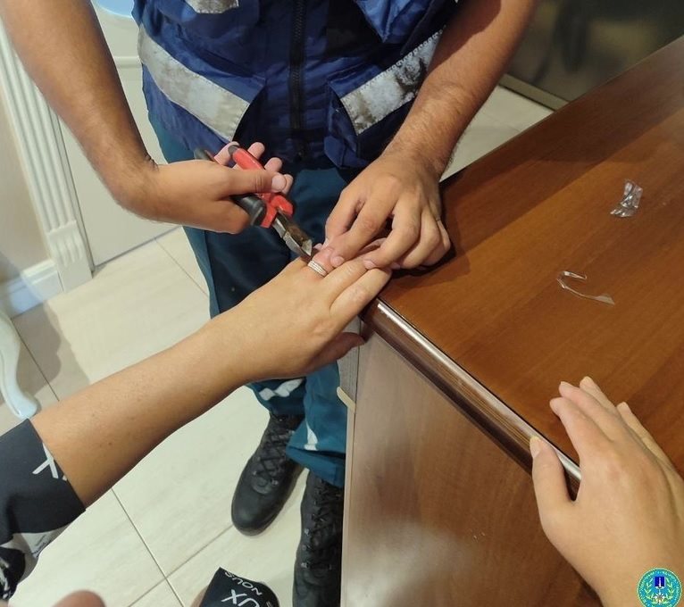 В Ульяновске спасатели помогли женщине снять кольцо с распухшего пальца