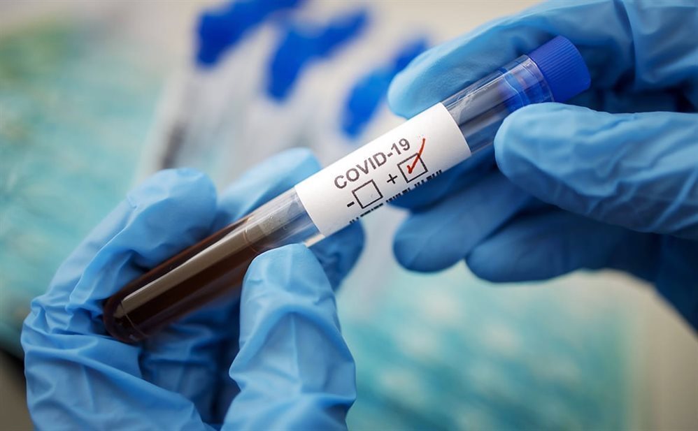 Список частных лабораторий, проводящих тест&nbsp; на коронавирус. Среди них три - в Ульяновске