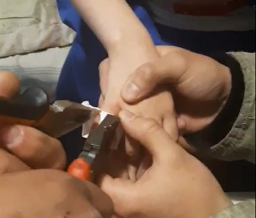 Димитровградские спасатели сняли с пальца малыша игрушку