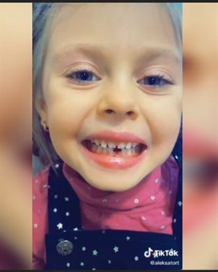 Что делать, если у ребенка шатается зуб?