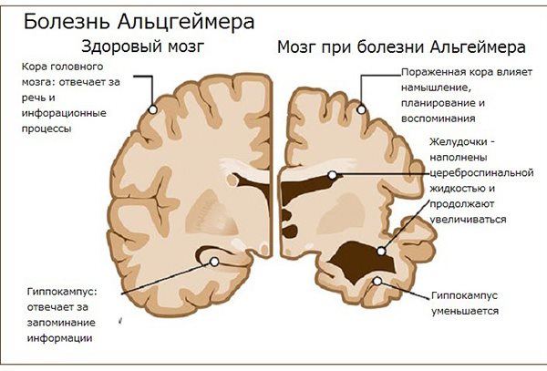 Здоровый сон и его важность для мозга